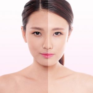 Hoạt chất trắng da